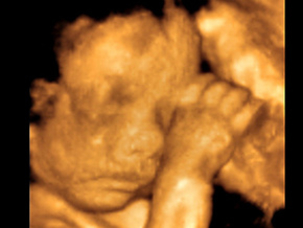 Тайная жизнь еще не рожденного ребенка