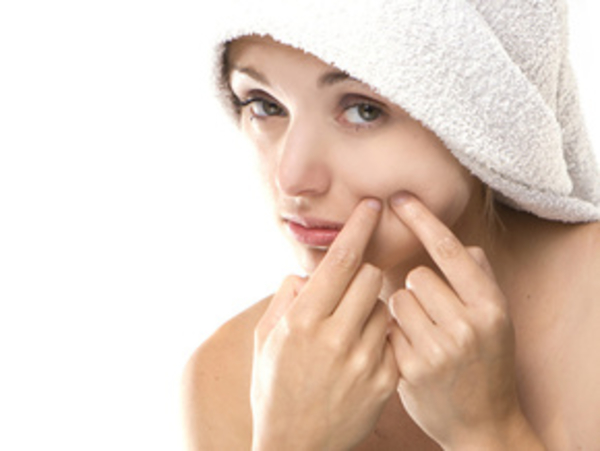 Лечение угрей