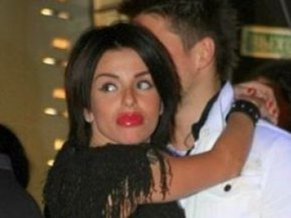 Лицо Юли Волковой  изуродовано