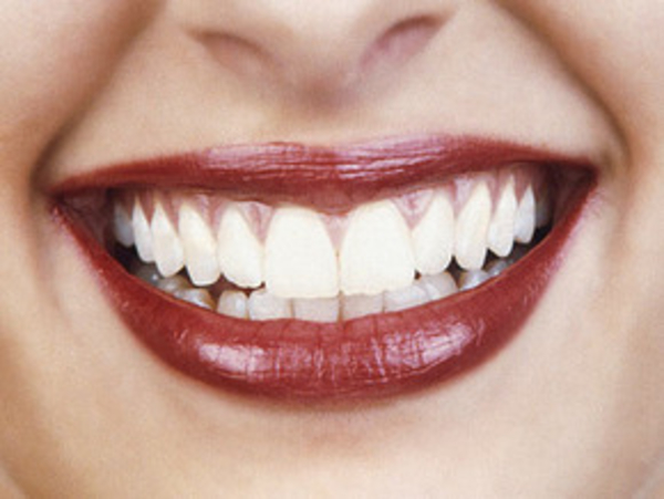 Испортить зубы может стресс