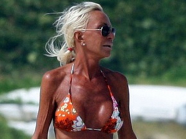 Донателла Версаче весит 40 килограммов. Ее дочь тоже страдает анорексией