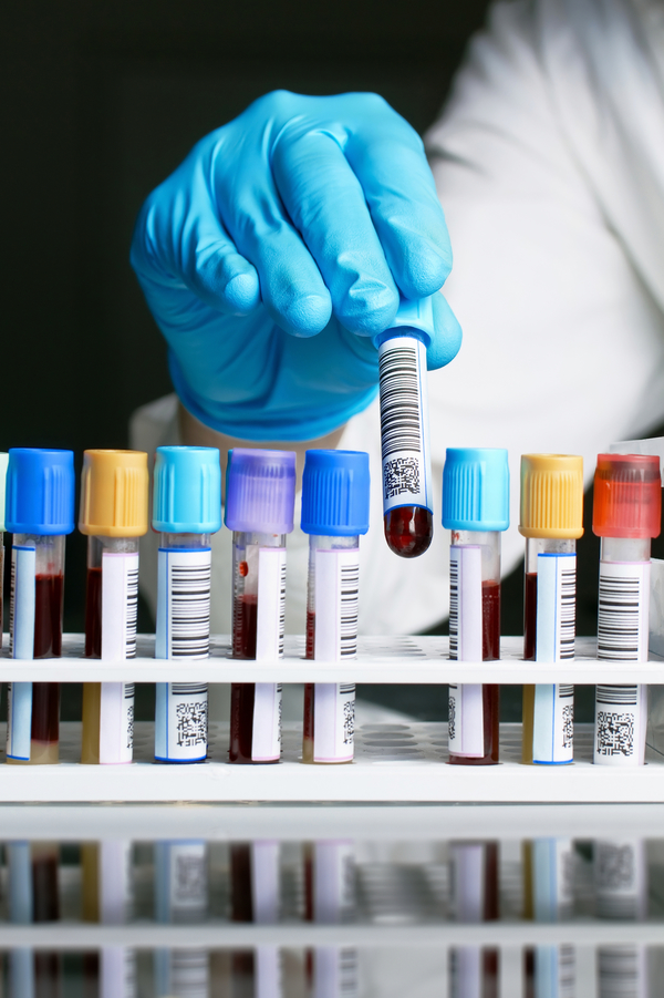 Сбор и хранение пуповинной крови.