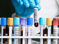 Сбор и хранение пуповинной крови.