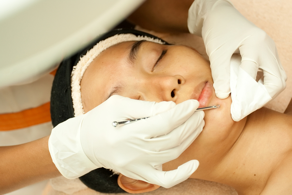 Профессиональный подход в лечении угревой сыпи