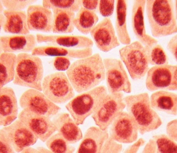 Золотые правила защиты от рака