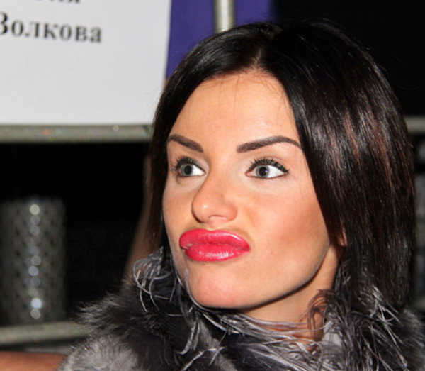 Волкова избавилась от силикона
