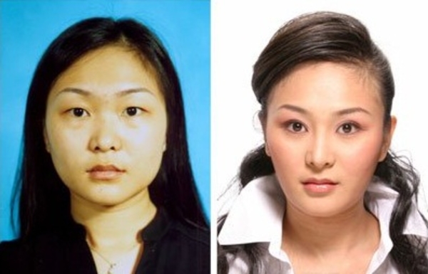 Корейских детей за успехи в учебе поощряют пластикой