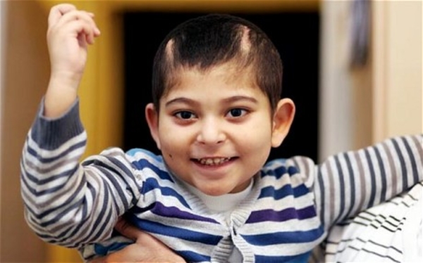 Медики вернули ребенку способность улыбаться