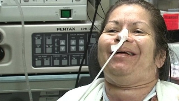 Женщине сделали пересадку гортани