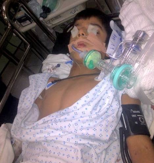 Школьник чуть не умер из-за халатности учителя