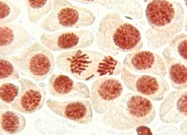 Давай поговорим о раке