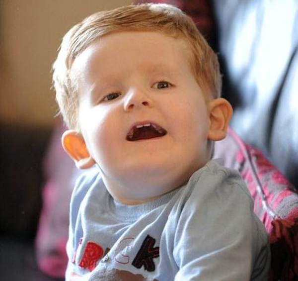 У ребенка из Англии обнаружили лишнюю нить ДНК