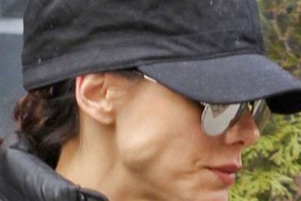 Лифтинг изуродовал Сандру Баллок