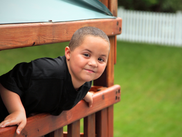 У детей с избыточным весом может развиться псориаз