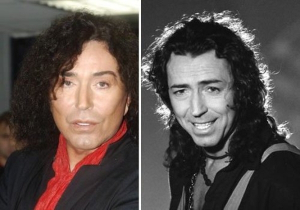 Как пластические операции меняют звездных мужчин