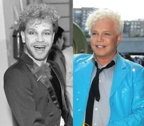 Как пластические операции меняют звездных мужчин