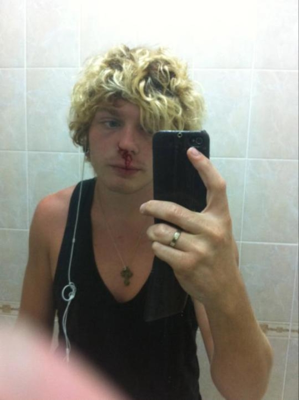 Александра Кривошапко избили?