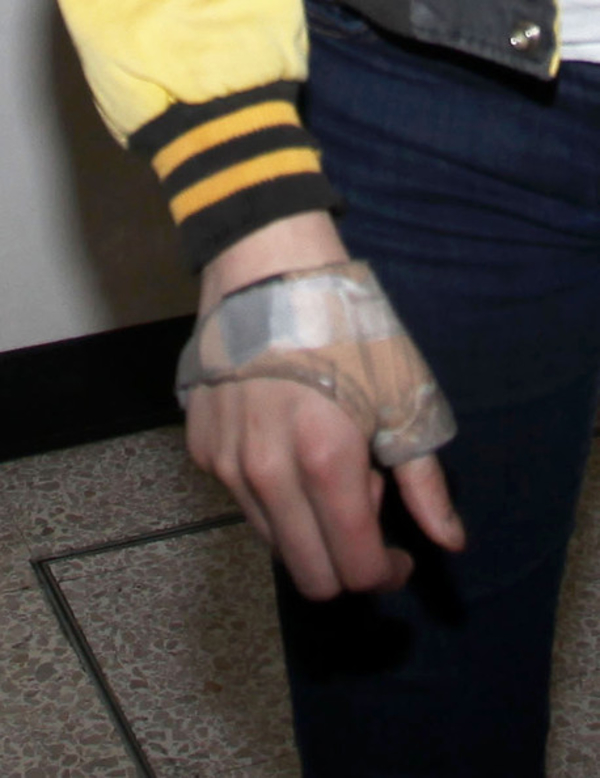 Звезда Сумерек Кристен Стюарт серьезно травмирована