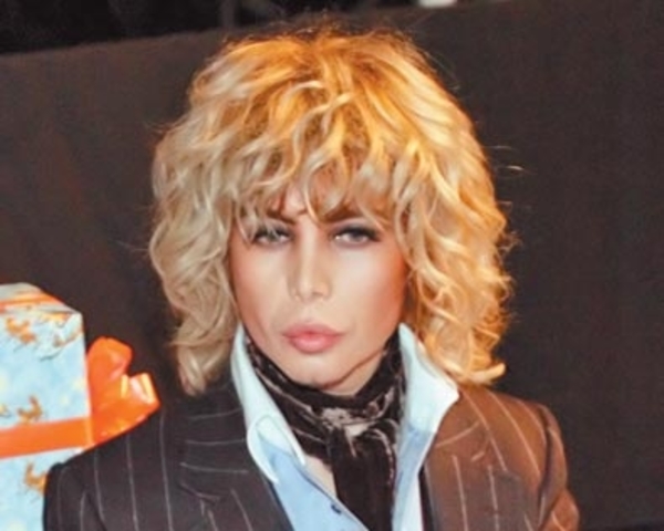 Сергей Зверев украсит свой гипс стразами и продаст на аукционе