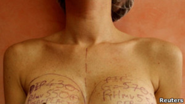 Грудные имплантаты: оправдывает ли красота риск?