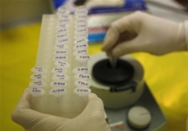 Ученые уверены, что риск инсульта связан с мутацией гена