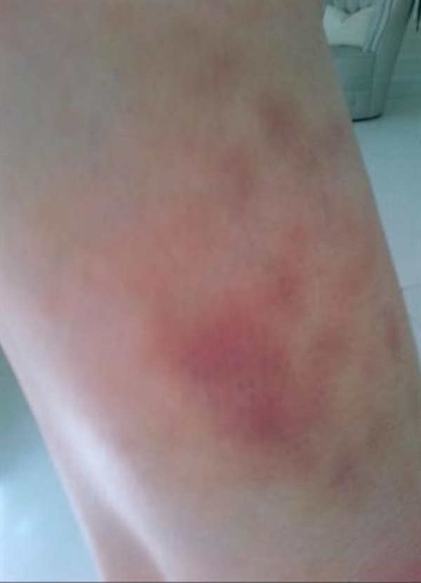 Мадонна пострадала в спортзале