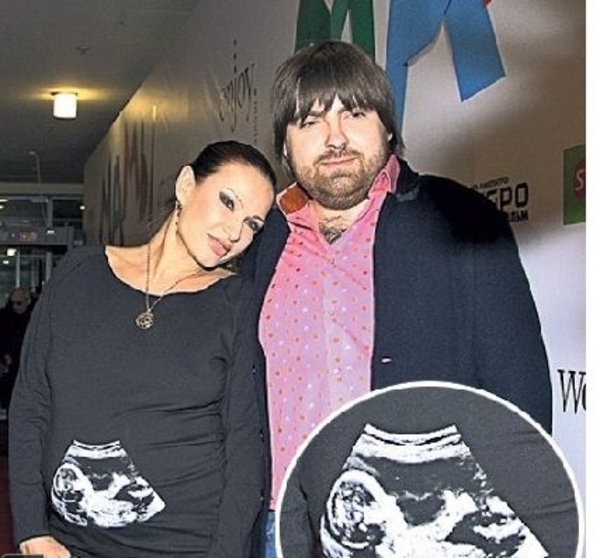 Эвелина Бледанс показала снимок УЗИ своей дочки