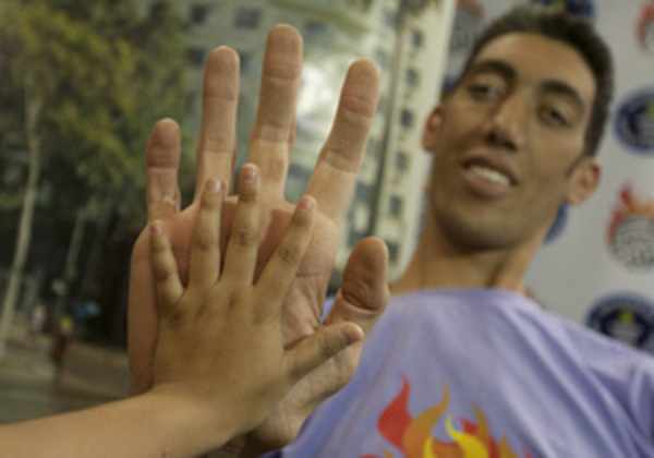 Специалисты остановили рост самого высокого человека планеты