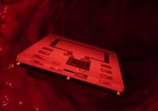 Тромбы в кровеносных сосудах будет разрушать миниатюрное устройство