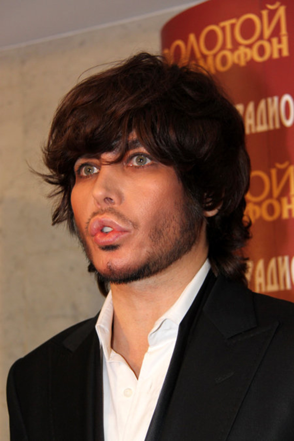 У Сергея Зверева после пластики не закрывается рот