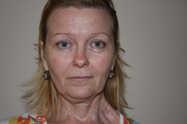 пресс-служба 1+1