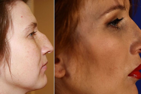 пресс-служба 1+1