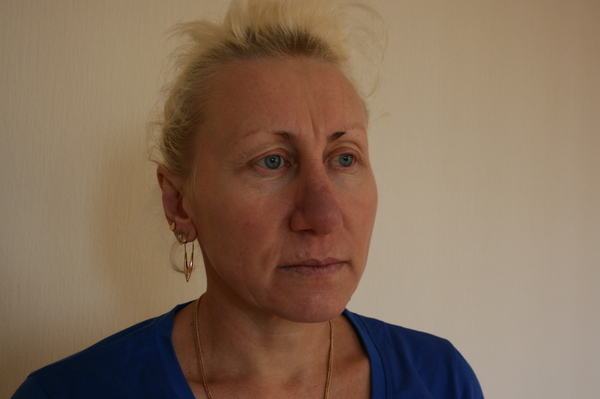 Операція Краса: История перерождения Валентины