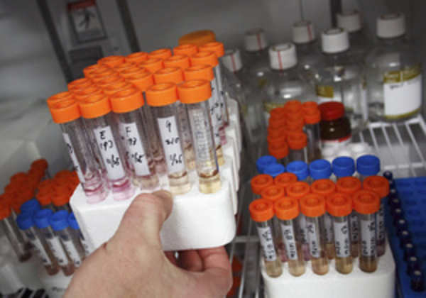 Предрасположенность к болезни Альцгеймера можно вычислить