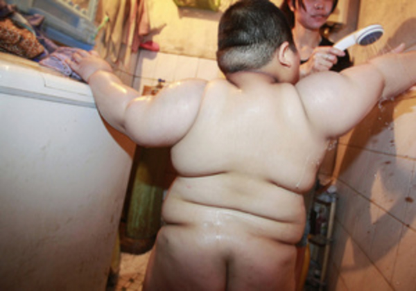 Биологи установили связь между микрофлорой кишечника, ожирением и диабетом