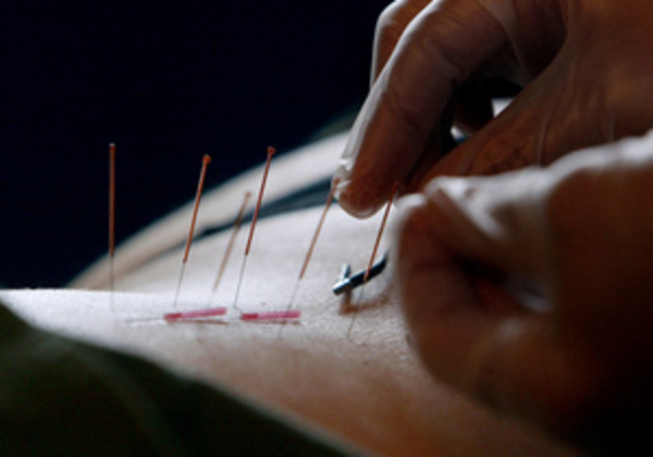 Иглоукалыватель из Швейцарии заразил ВИЧ-инфекцией 16 человек