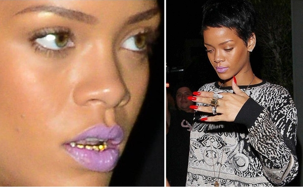 Рианна вставила себе золотые зубы