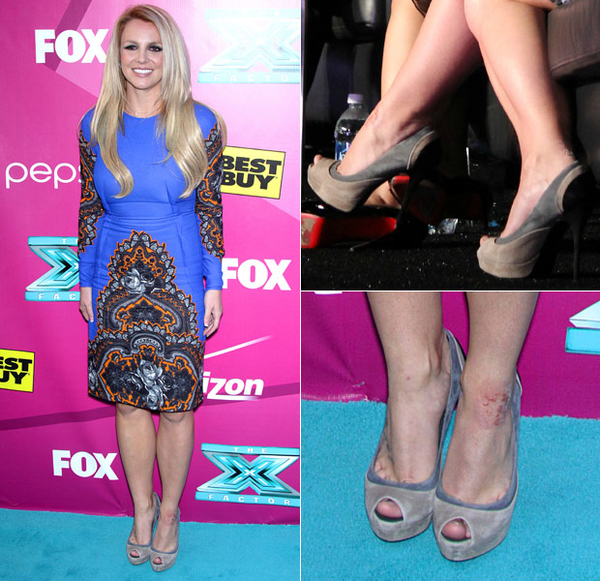 Бритни Спирс рассказала о своей неизлечимой болезни