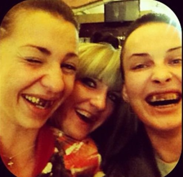 Даша Астафьева показала свои страшные фото с "испорченными" зубами