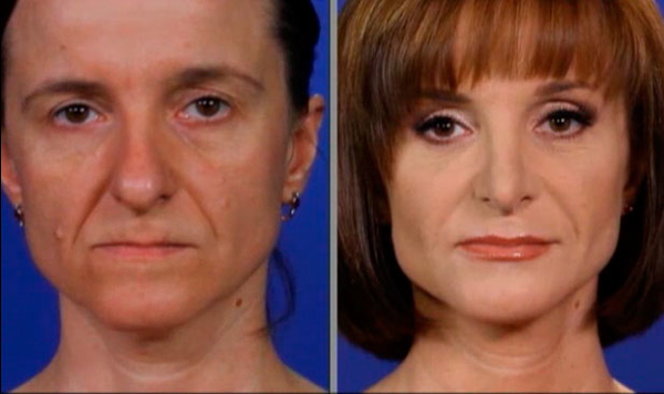 Операцiя краса: Наталья Веревка изменила свою внешность к свадьбе