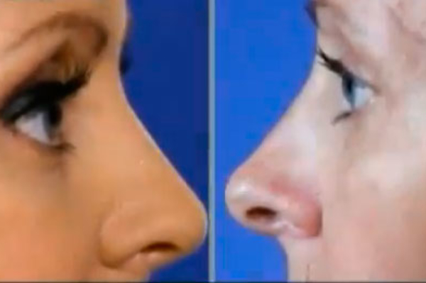 скриншот программы Операція Краса