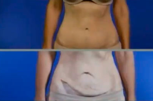 скриншот программы Операція Краса