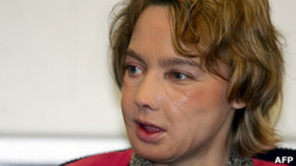 Изабель Динуар: Как живет женщина после первой в мире пересадки лица