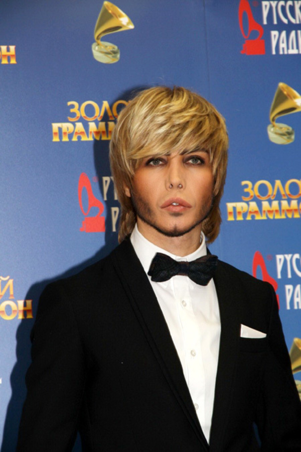 У Сергея Зверева из-за пластики "съехал" в сторону нос