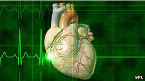 Пациенту-сердечнику спасла жизнь инъекция спирта