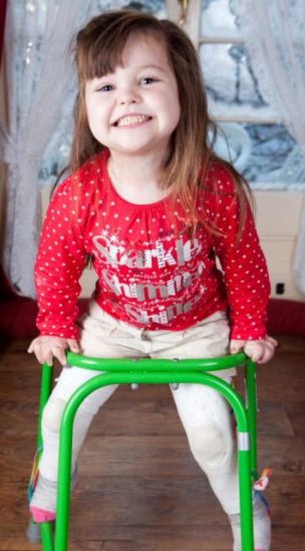Чудо: 5-летняя британка, получившая 86% ожогов кожи, полностью восстановилась