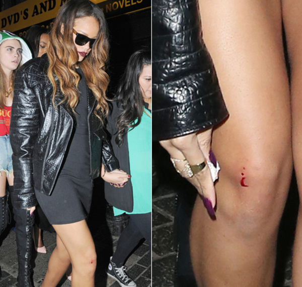 На Рианну напал фанат