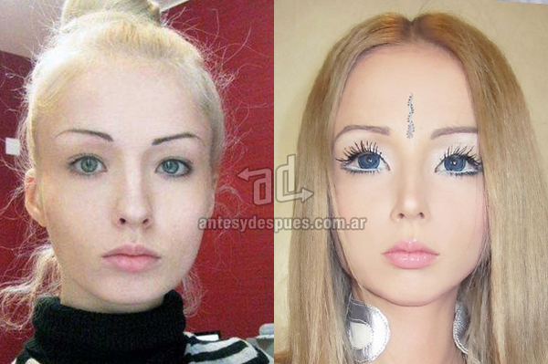 antesydespues.com.ar