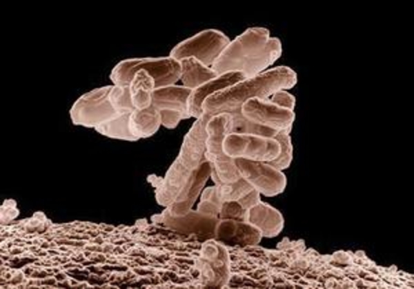 В Британии скончался больной от атипичной пневмонии