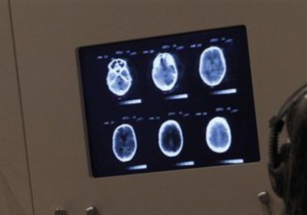 В мозге человека нашли центр чувства собственного превосходства